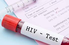 Kasus IRT Positif Mengidap HIV meningkat di 2023, Kemenkes Ungkap Penyebabnya  