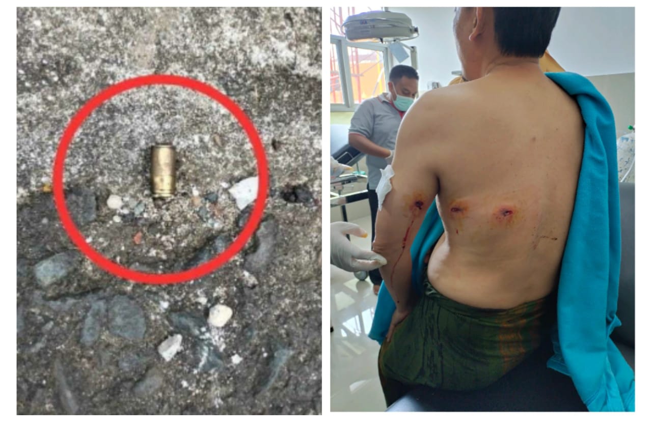 Apa Motif Penembakan Terhadap Rahiman Dani eks DPRD Provinsi Bengkulu? Ini Keterangan Kapolda Bengkulu  