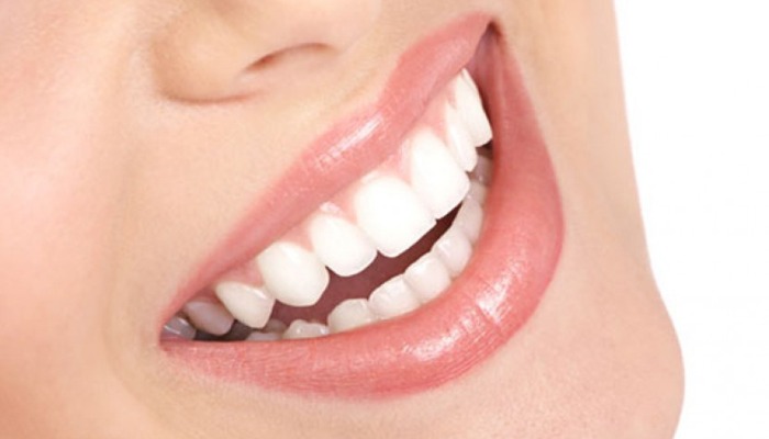 Ingin Gigi Putih Bersinar? Coba Deh 5 Tips Ampuh Hilangkan Plak Gigi Berikut, Nomor 4 Penting Banget