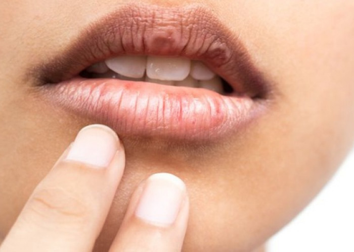 3 Penyebab Bibir Hitam yang Mungkin Belum Kamu Tahu dan Cara Praktis Kembali ke Warna Bibir Cerah!